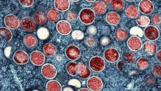 中疾控：猴痘已在全球70多个国家和地区传播，我国尚未发现
