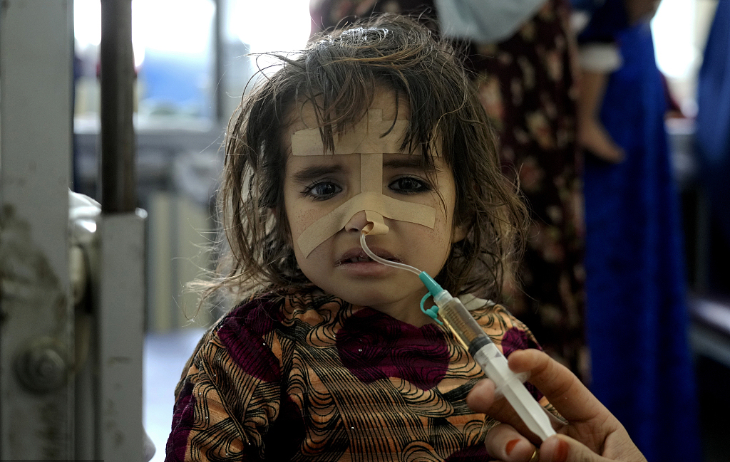 当地时间（shijian）2022年5月18日，阿富汗喀布尔，因营养不良在医院接受治疗的(de)孩童。预计今年将有110万儿童出现严重消瘦症状，比2018年增加近一倍。