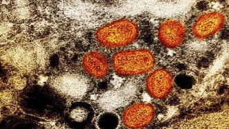 宠物狗感染猴痘，疑似首例“人传狗”，美国CDC改防控指南
