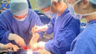 “镜面人”同时患上肝癌和肾癌，在上海手术后一周顺利出院