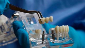 种牙医疗服务价格调控三大看点：如何保障质价相符种牙服务？