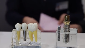 4500元的种植牙医疗服务指导价，是硬杠杠还是能浮动？