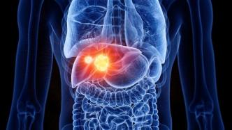 淋巴结上培养“微型肝脏”，离肝移植手术补充方案还有多远
