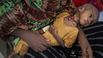 早安·世界｜联合国儿基会：索马里儿童面临严重营养不良