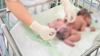新生男婴长出“松鼠尾巴” ，医生摘除1.3斤畸胎瘤
