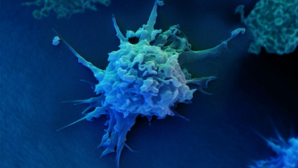 研究发现：结直肠癌细胞化疗死亡后促进周围肿瘤细胞存活的机制