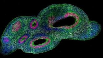 三维类器官可用于探究早期癌症发展：干细胞基因编辑再突破