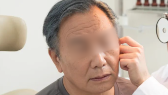 男子陽后耳朵抽出積液：擤鼻過猛引發中耳炎