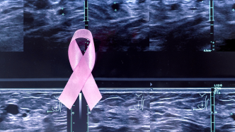 科普｜不同年齡的女性，如何正確選擇乳腺疾病的影像檢查方式？