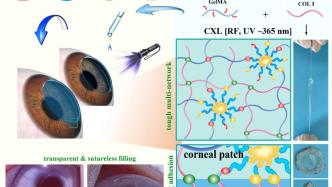 上海市五官科医院最新研究：新型光固化水凝胶可促进角膜修复