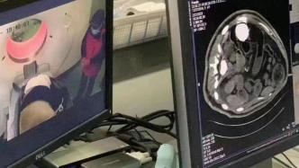 上海医院有名为“熊猫”的患者做CT？上野：确系熊猫七七