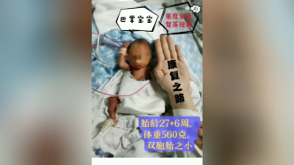 出生仅1斤1两的广州“巴掌宝宝”会走路了