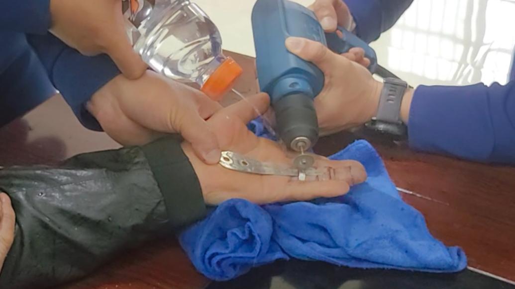 手指受傷戒指取不下來,男子到消防隊求助