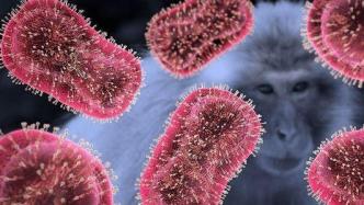 澳门卫生局：香港新增猴痘个案在澳门感染的可能性不大
