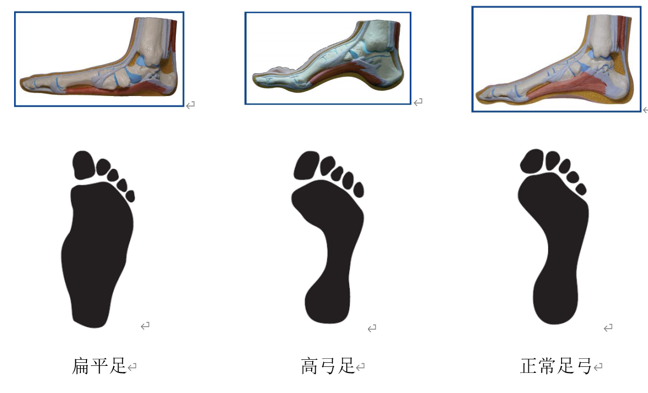 专注于足部与体姿态健康数据 | 深圳创感科技有限公司