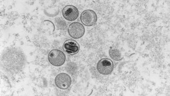 中国内地新增报告106例猴痘确诊病例，有何特点？专家解读