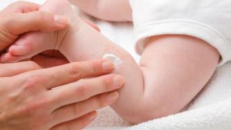 科普｜夏季婴幼儿湿疹如何护理？吃穿住要注意什么？
