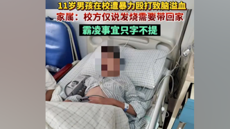广东清远11岁男孩疑因同学殴打致脑溢血，校方、教育局回应