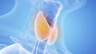 中国首个“局部进展期甲状腺癌新辅助治疗专家共识”发布