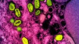 中疾控：9月新增报告305例猴痘确诊病例