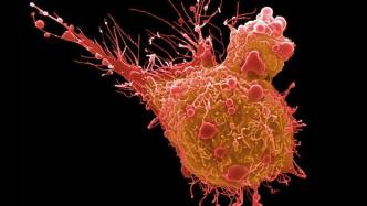 膀胱癌治疗取得前所未有的成功：试验结果显示“武器化”抗体威力