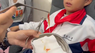 儿童经“消鼻甲”治鼻炎后鼻腔糜烂，医生：损伤不可逆