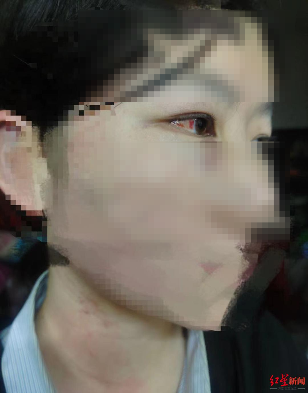 初二女生被拖入地下道施暴,其父悬赏寻凶:3名施暴者均未成年