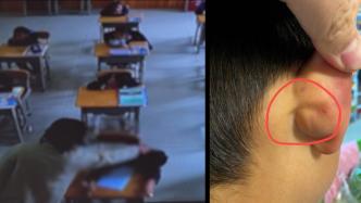 昆明一7岁学生遭老师掐耳朵扯头发扇耳光？涉事教师去年入职，已被学校开除