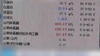南京60岁男子长期频繁染发致肝衰竭