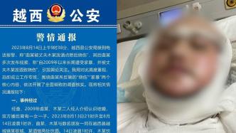 女子称被丈夫烧伤，四川越西警方：暂未发现证据不予立案