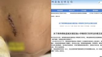 河南桐柏县通报“老师教具碰到学生鼻梁致其受伤”：教师道歉