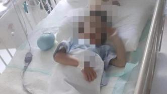5岁男童被生母虐致双腿截肢案将再开庭，父亲：孩子仍在住院