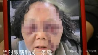 把户口迁入了老房子，78岁老太遭继子殴打，矛盾如何解？