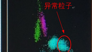 22岁小伙突然发烧头痛咳嗽，竟是因为一年多前出国游玩