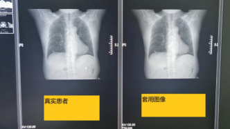 國家醫保局：無錫虹橋醫院涉嫌違法違規使用醫保基金2228.4萬元