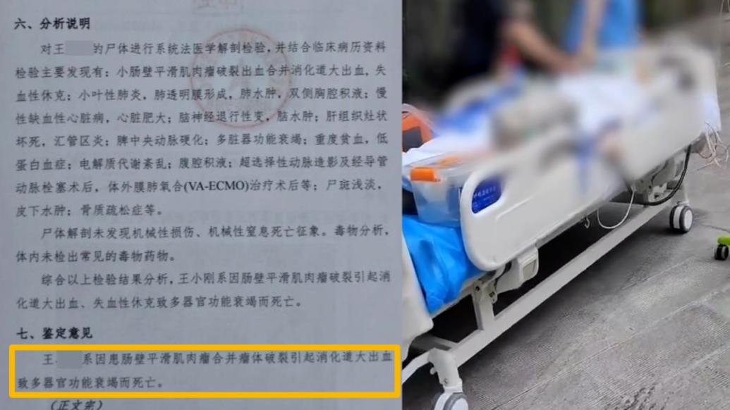 精神病人看守所內(nèi)腹痛后死亡，尸檢顯示消化道大出血