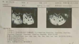 江西南昌一女子注射促排卵針后懷上九胞胎，專家解讀