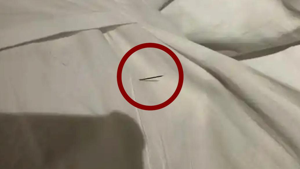 枕头暗藏针头扎伤游客?酒店回应