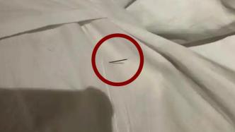 枕頭暗藏針頭扎傷游客？酒店回應