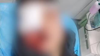 男子除夕夜被煙花射中右眼球摘除，警方已立案調查