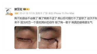 郭艾倫打球眼睛被戳縫40多針，陶勇醫(yī)生談“結(jié)膜受傷”