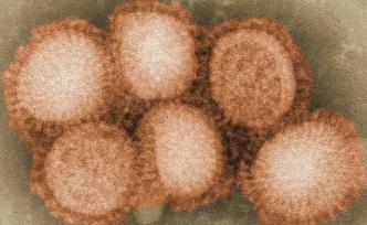 “华山感染”最新文章：其他五次PHEIC之墨西哥流感