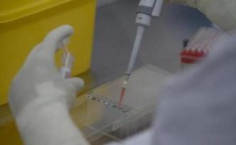 钟南山团队：咽漱液用于新冠病毒核酸检测准确率高于鼻拭子
