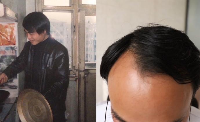 我在精神病科工作15年,男護士講述