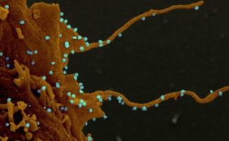 新冠病毒感染细胞显微图像首次公布，专家称传播方式“邪恶”