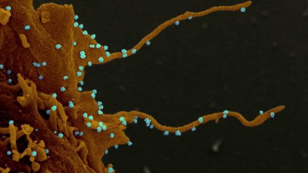 新冠病毒感染细胞显微图像首次公布，专家称传播方式“邪恶”
