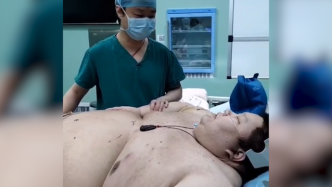 疫情期间暴增两百斤，武汉五百斤胖小伙做减重手术