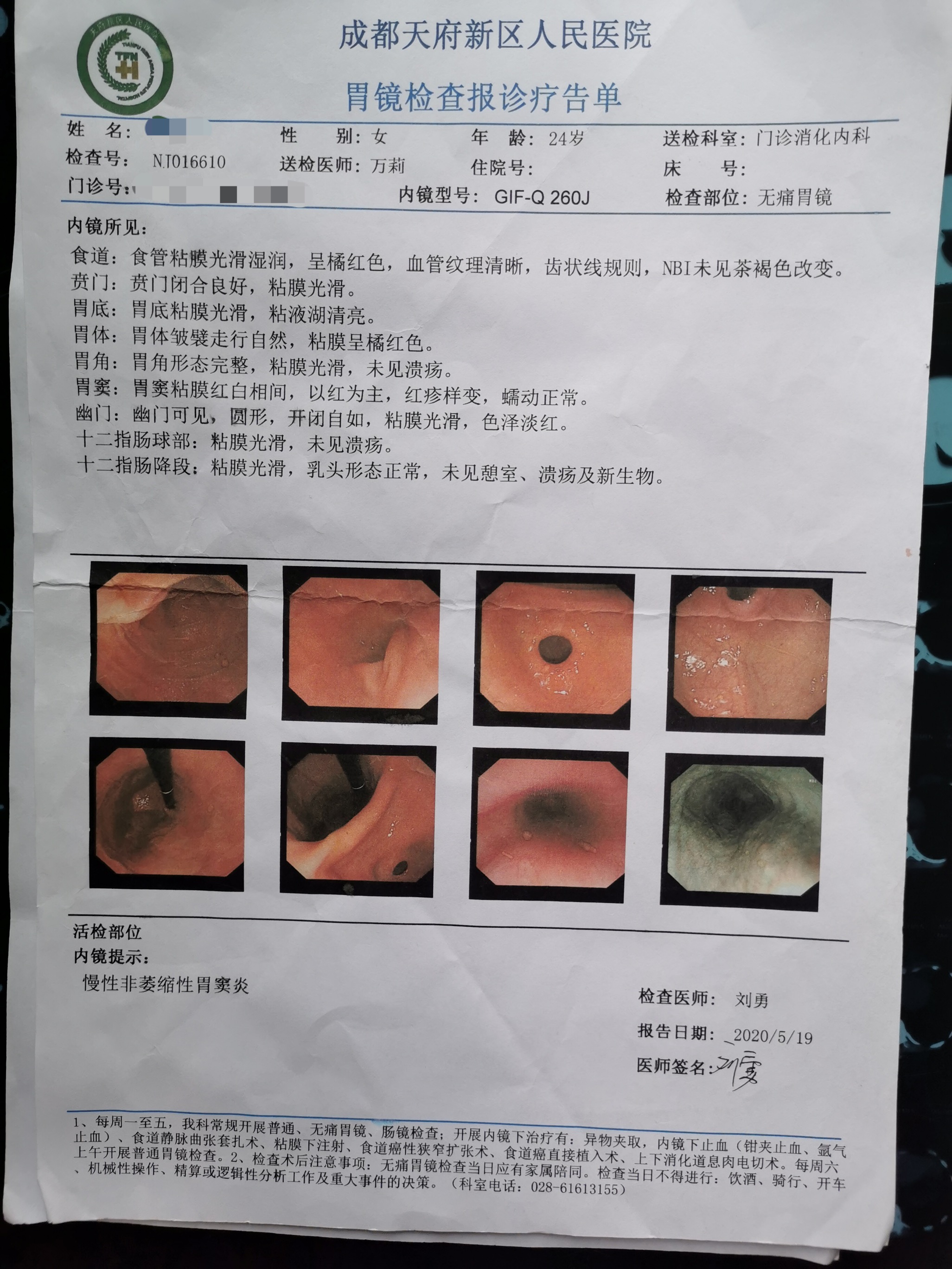 程露5月19日在天府新区人民医院复查的胃镜报告单