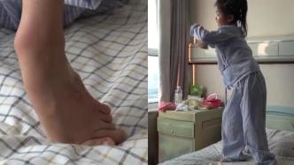 山东7岁左脚变形跳舞女孩接受矫正手术