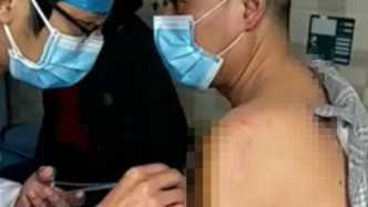 男子疫情期戴口罩被打骨折：伤人者获刑8个月，检方要求重罚